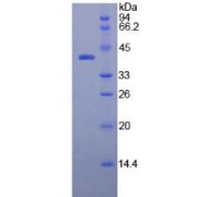 SDS-PAGE analysis of Rat Osteocalcin Protein.