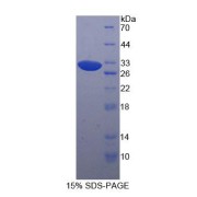 SDS-PAGE analysis of Human PAK4 Protein.