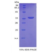 SDS-PAGE analysis of recombinant Human PNMA2 Protein.