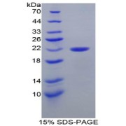 SDS-PAGE analysis of Human PARK7 Protein.