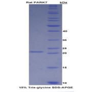 SDS-PAGE analysis of Rat PARK7 Protein.