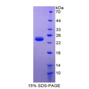 SDS-PAGE analysis of Mouse PARK7 Protein.