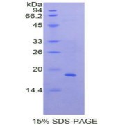 SDS-PAGE analysis of Human Periostin Protein.