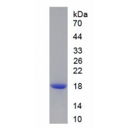 SDS-PAGE analysis of recombinant Human Peroxiredoxin 2 Protein.