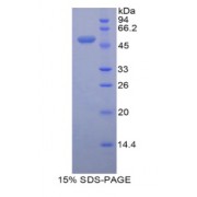 SDS-PAGE analysis of recombinant Mouse Peroxiredoxin 3 Protein.