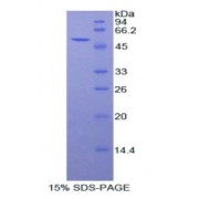 SDS-PAGE analysis of Rat Peroxiredoxin 6 Protein.