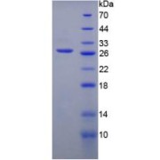 SDS-PAGE analysis of Human PFKP Protein.