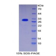 SDS-PAGE analysis of Human PIK3C2a Protein.