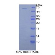 SDS-PAGE analysis of Human PLAA Protein.