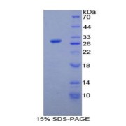 SDS-PAGE analysis of Rat iPLA2 Protein.