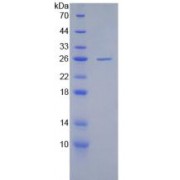 SDS-PAGE analysis of Human cPLA2 Protein.