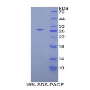 SDS-PAGE analysis of Human PLCg1 Protein.