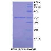 SDS-PAGE analysis of Rat Pim-2 Oncogene Protein.