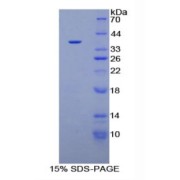 SDS-PAGE analysis of recombinant Human Plasminogen Protein.