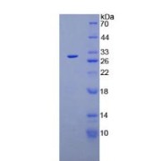 SDS-PAGE analysis of recombinant Mouse Plasminogen Protein.