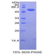 SDS-PAGE analysis of Human tPA Protein.