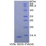 SDS-PAGE analysis of recombinant Human uPAR Protein.