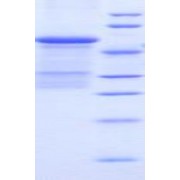SDS-PAGE analysis of Mouse uPAR Protein.