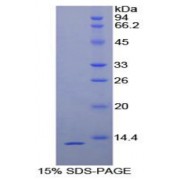 SDS-PAGE analysis of recombinant Human uPAR Protein.