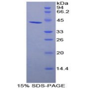 SDS-PAGE analysis of recombinant Human uPAR Protein.