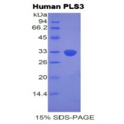 SDS-PAGE analysis of Human Plastin 3 Protein.