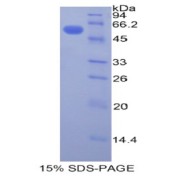 SDS-PAGE analysis of Human Plastin 3 Protein.