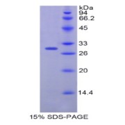 SDS-PAGE analysis of Human Plastin 3 Protein.