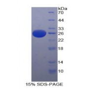 SDS-PAGE analysis of Human PAFAH1B3 Protein.