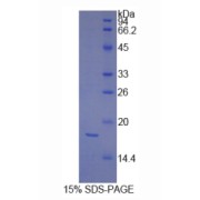 SDS-PAGE analysis of Human PDGFC Protein.