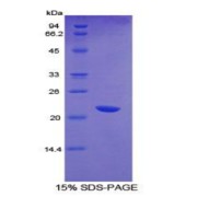 SDS-PAGE analysis of recombinant Mouse CD36 Protein.