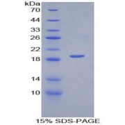 SDS-PAGE analysis of Mouse PECAM1 Protein.