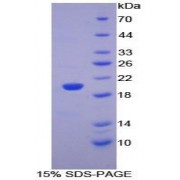SDS-PAGE analysis of Mouse PHLDA2 Protein.