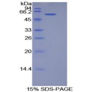 SDS-PAGE analysis of Human Podocalyxin Protein.