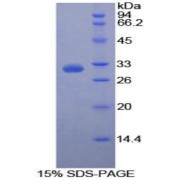 SDS-PAGE analysis of Human Poliovirus Receptor Protein.