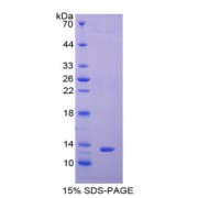 SDS-PAGE analysis of Rat PIGR Protein.