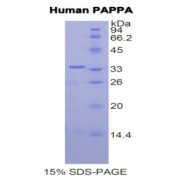 SDS-PAGE analysis of recombinant Human PAPPA Protein.