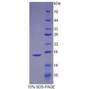 SDS-PAGE analysis of Rat Preprovasopressin Protein.