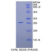 SDS-PAGE analysis of recombinant Mouse Prion Protein.