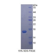 SDS-PAGE analysis of recombinant Human Procalcitonin Protein.