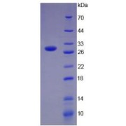 SDS-PAGE analysis of recombinant Human PD-L1 Protein.