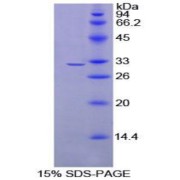 SDS-PAGE analysis of Rat PDCD1LG2 Protein.
