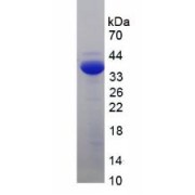 SDS-PAGE analysis of recombinant Human Adrenocorticotropic Hormone Protein.