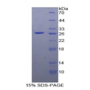 SDS-PAGE analysis of recombinant Human EP2 Protein.