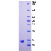 SDS-PAGE analysis of Human PSCA Protein.