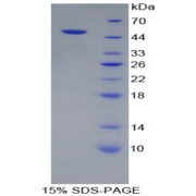 SDS-PAGE analysis of Human PSMC3 Protein.