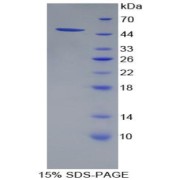 SDS-PAGE analysis of Human PSMC4 Protein.