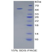 SDS-PAGE analysis of Human PSMC6 Protein.