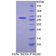 SDS-PAGE analysis of Human PSMD2 Protein.