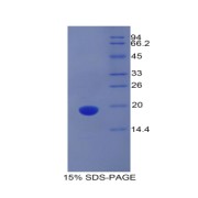 SDS-PAGE analysis of Mouse PROCR Protein.