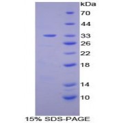 SDS-PAGE analysis of recombinant Human PKCe Protein.